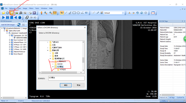 MicroDicom(医学看图软件) V2.9.2 Win32位版1