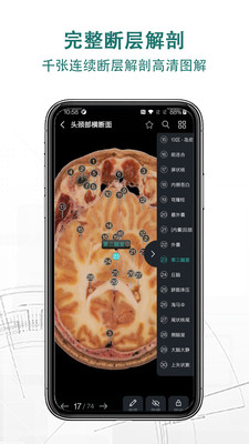 掌上3D解剖0